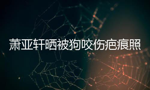被狗疤痕皮中照片在养萧亚轩晒细胞脸咬伤坏死 还
